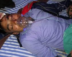 Photo of अपराधियों ने आशिर्वाद माइक्रो फिनांस कम्पनी के एजेंटको मारी गोली