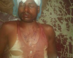 Photo of रास्ता विवाद में पंचों के साथ मारपीट, दो महिला सहित आठ घायल
