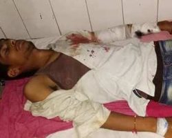 Photo of NSUI छात्र संघ के महासचिव अक्षय आनंद पर हमला